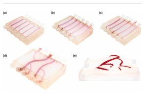 Photographs of dermis phantoms demonstrating designs achievable with the described method (a) straight channels; (b) curved channels; (c) 3-D channels; (d) 3-D branched networks; (e) open 3-D branched networks.