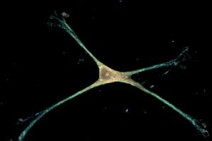 An astrocyte on the novel nanowire platform